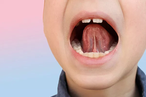 Child's open mouth displaying tongue and teeth against pink and blue gradient background.