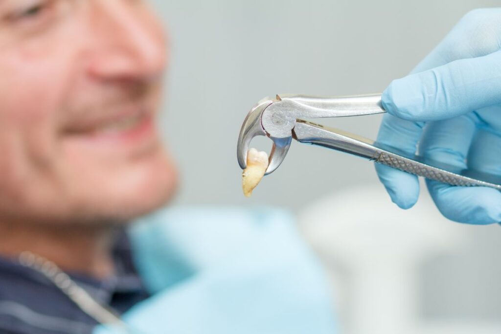 Teeth Extractions in Rockville Centre NY