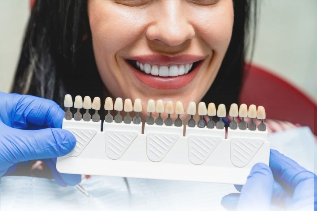 Dental Veneers in Rockville Centre