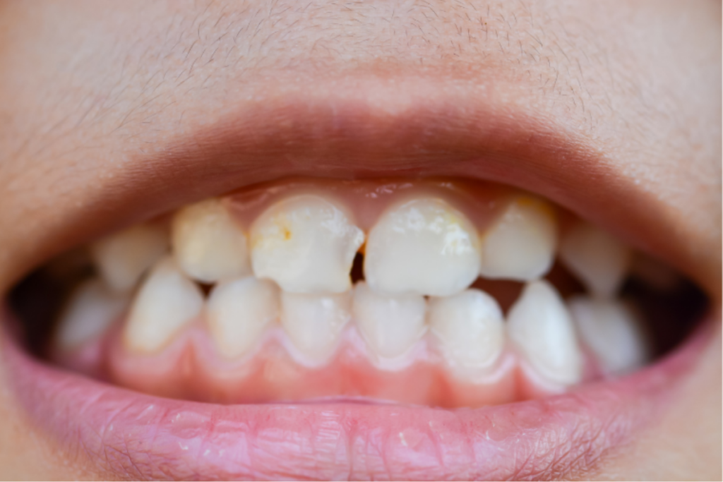 cosmetic dentist near Rockville Centre