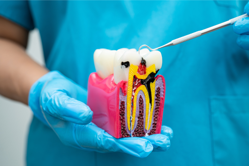 root canal therapy in Rockville Centre