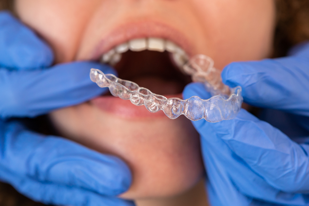 invisalign in Rockville Centre