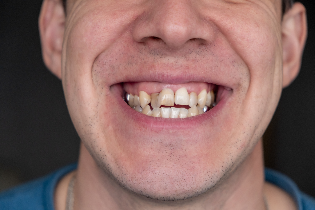 cosmetic dentist near Rockville Centre