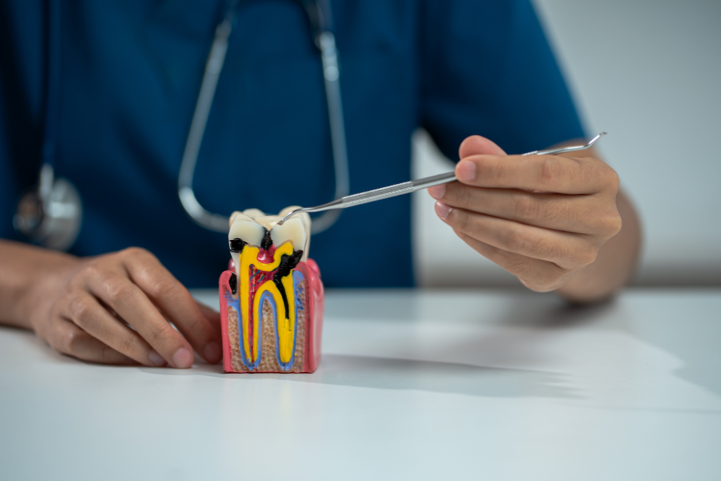 root canal therapy in Rockville Centre