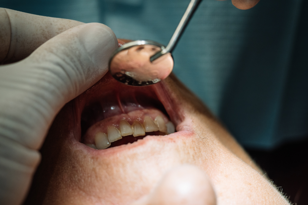 Featured image for “How Long Can You Wait to Treat a Dental Abscess?”